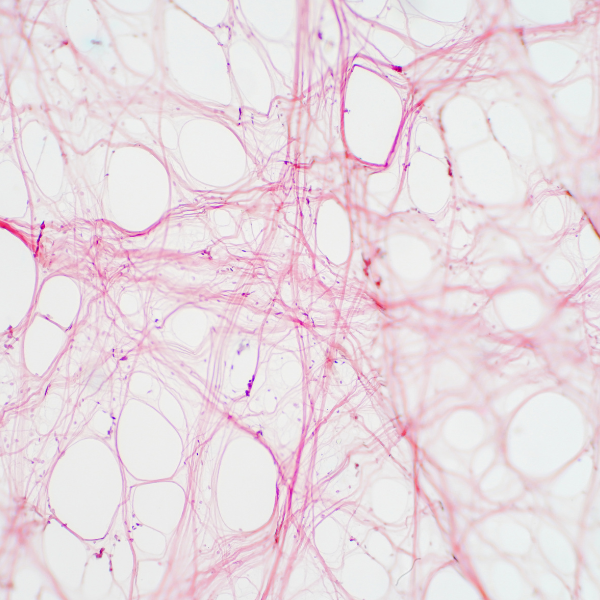 Glucosamine bij Morgen is Nu